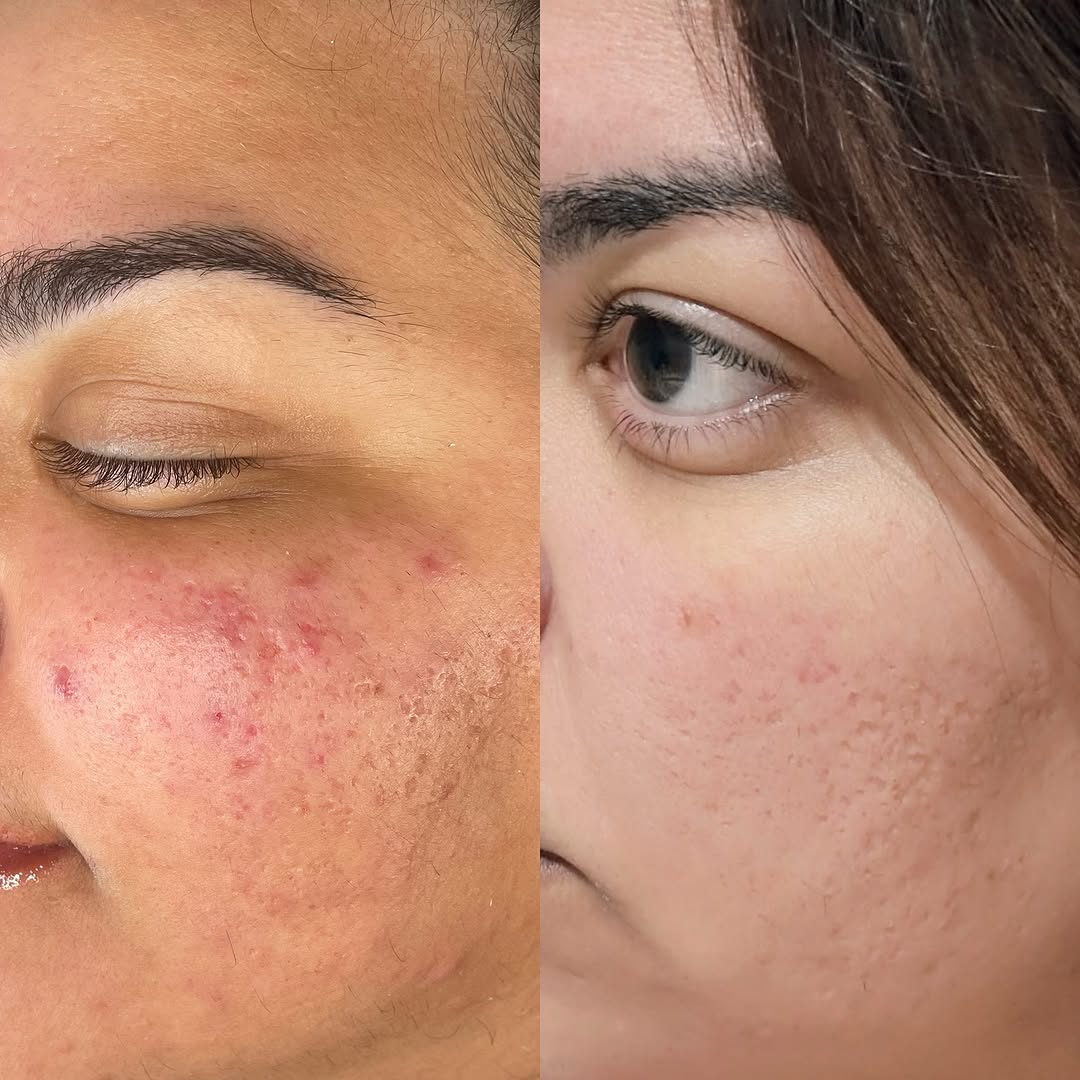 Belface Beauty Care